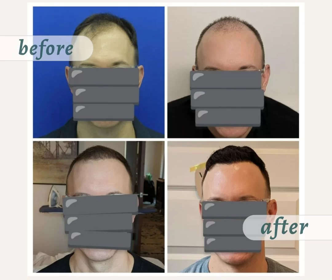 Результат пациента 7